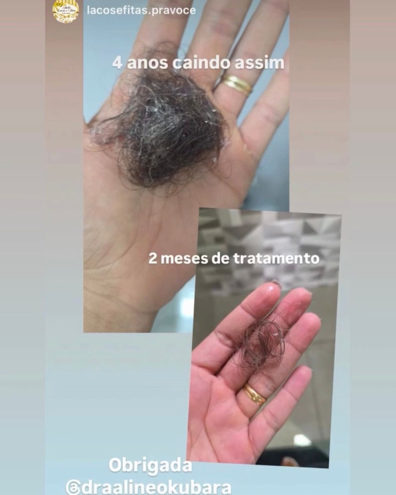 Depoimento 2